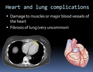 late complications hear lungs